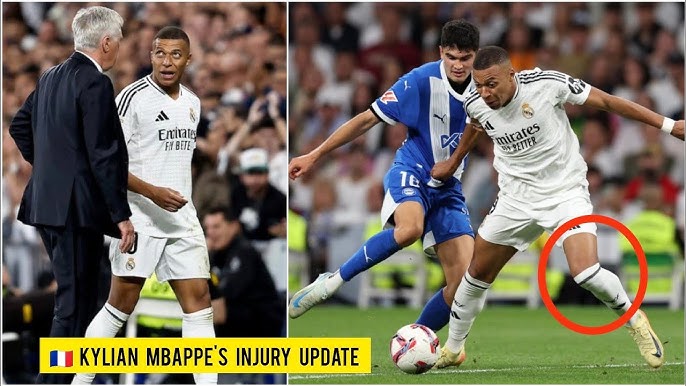  Kylian Mbappé INJURY UPDATE: Real Madrid star Kylian Mbappé is INJURED  | mbappe injury news